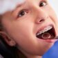 Oakland Orthodontist 85x85