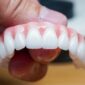 Zirconia Teeth Close Up 85x85