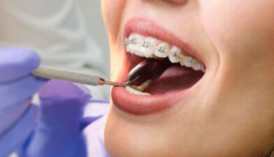 orthodontist yuba city