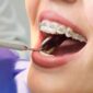 orthodontist yuba city 85x85