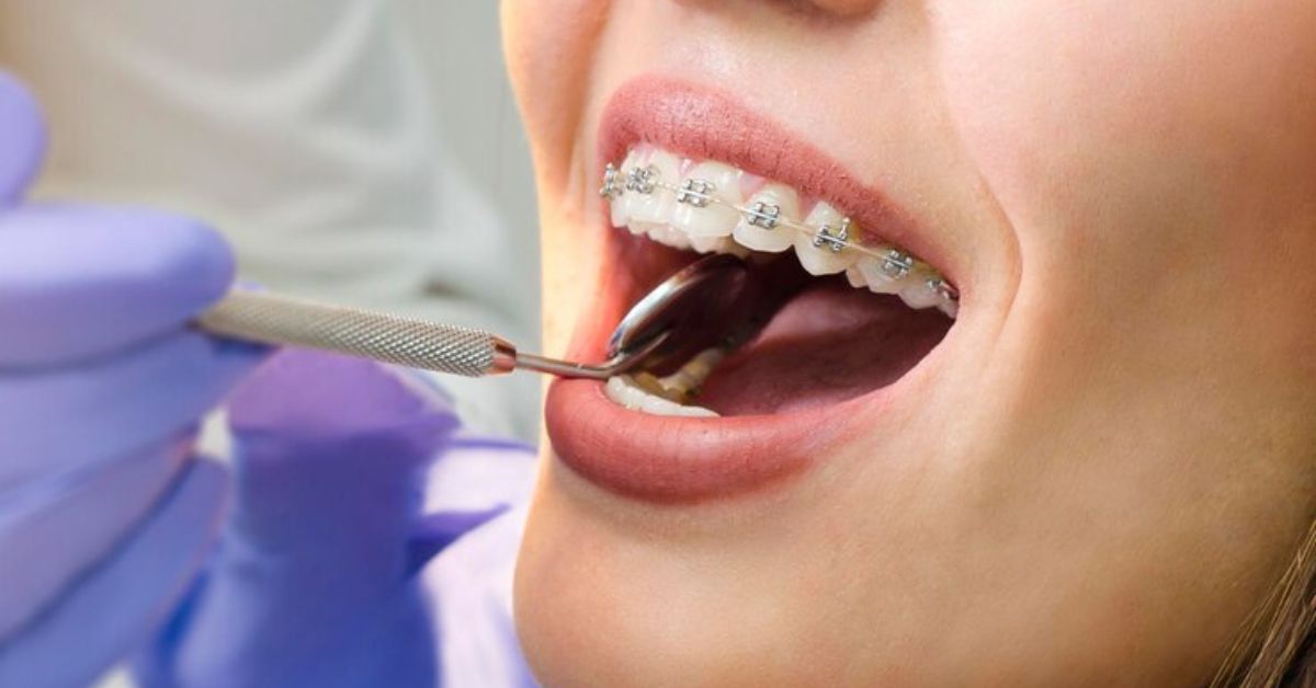 orthodontist yuba city
