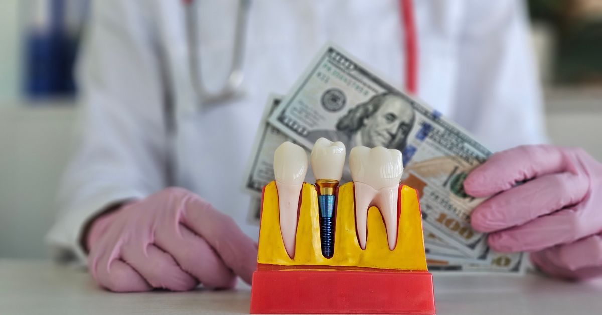 what is the average price for dental implants