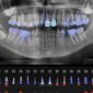 How AI Is Changing Dentistry 85x85