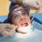 can worn down teeth be repaired 85x85