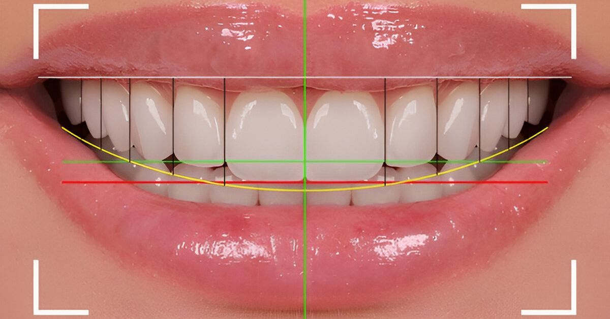 d2740 dental code