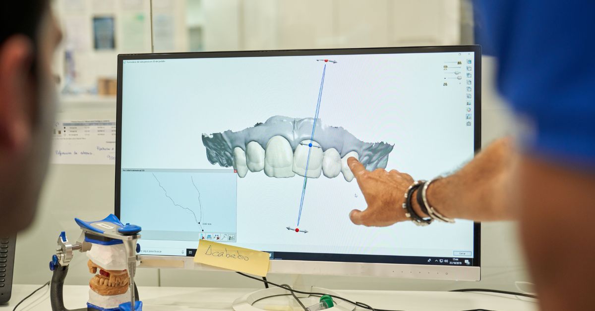 d9120 dental code