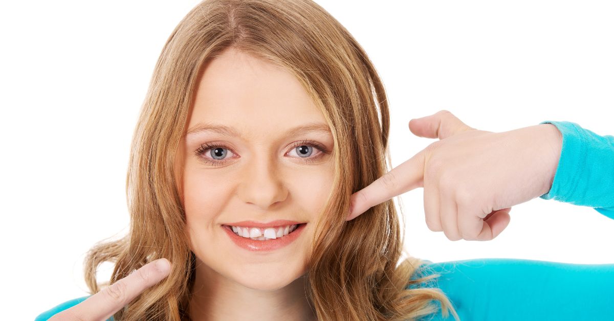 what is dental arch