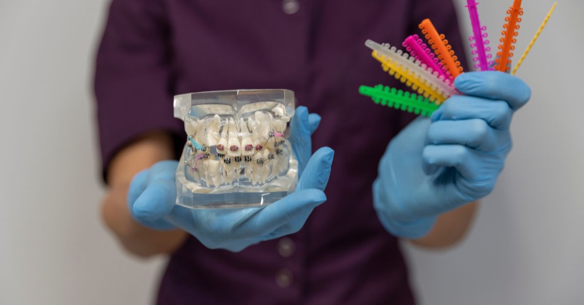 what is dental cement