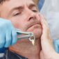 when can i eat chips after wisdom teeth removal 85x85