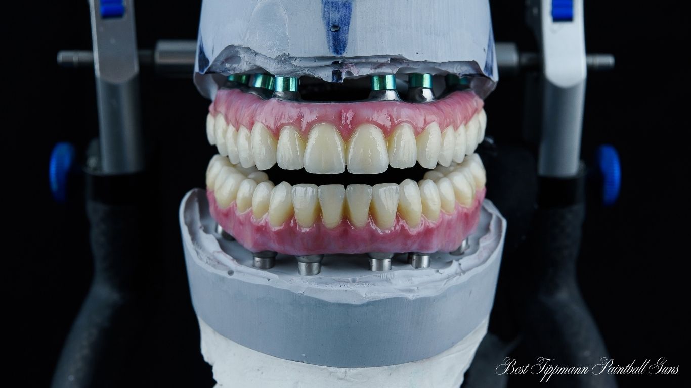 New Dental Implants
