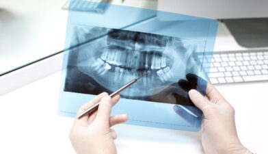 d6010 dental code