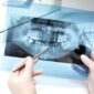 d6010 dental code 85x85