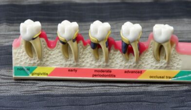 d2954 dental code