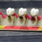 d2954 dental code 85x85