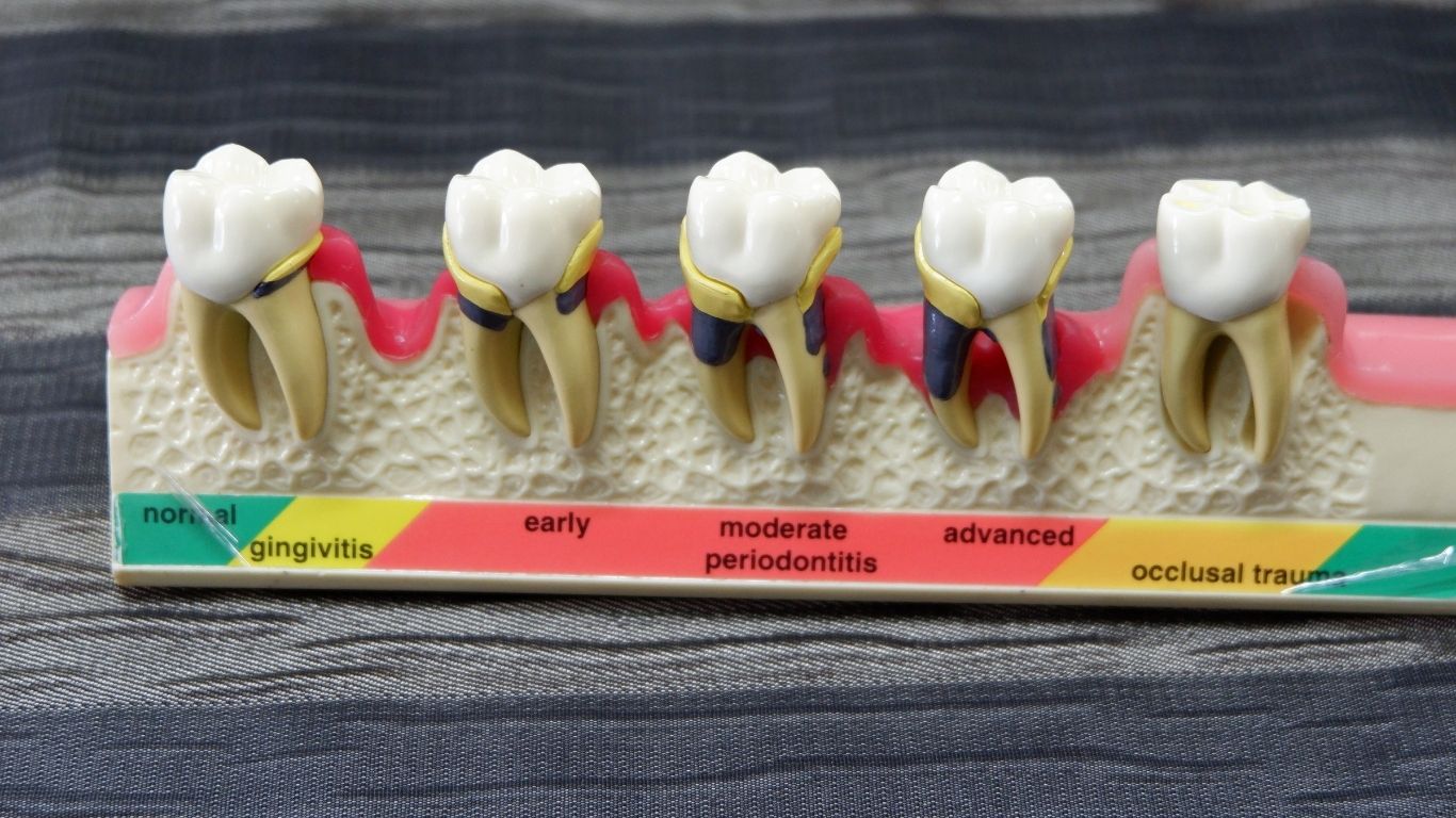 d2954 dental code