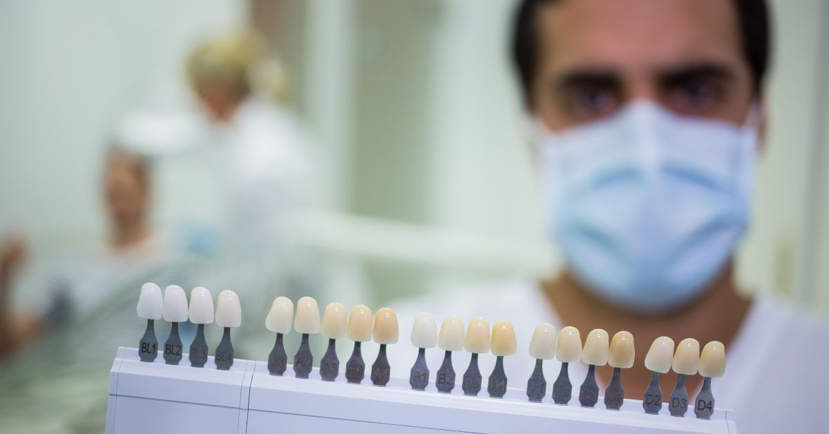 dental veneers for missing teeth