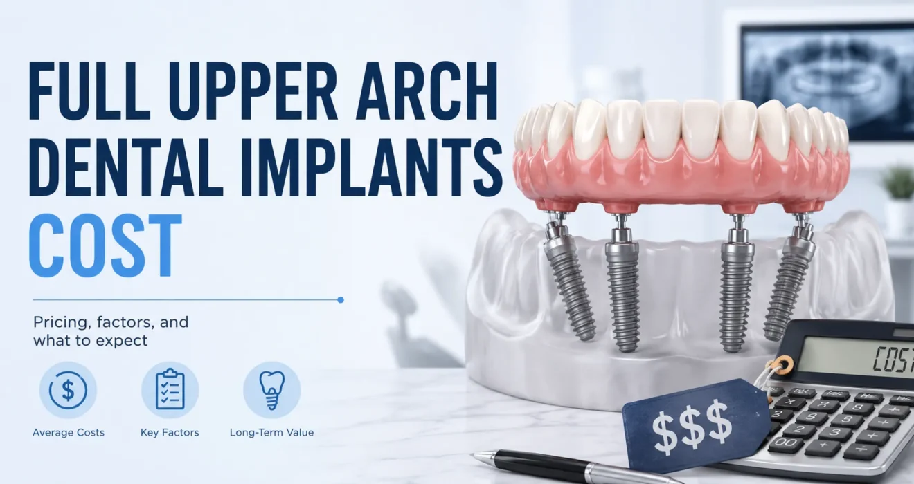 full upper arch dental implants cost