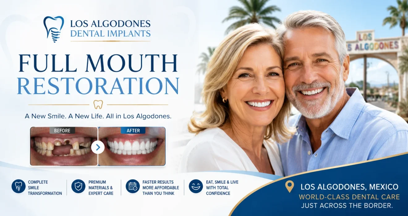 los algodones dental implants