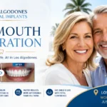 los algodones dental implants
