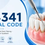 d4341 dental code