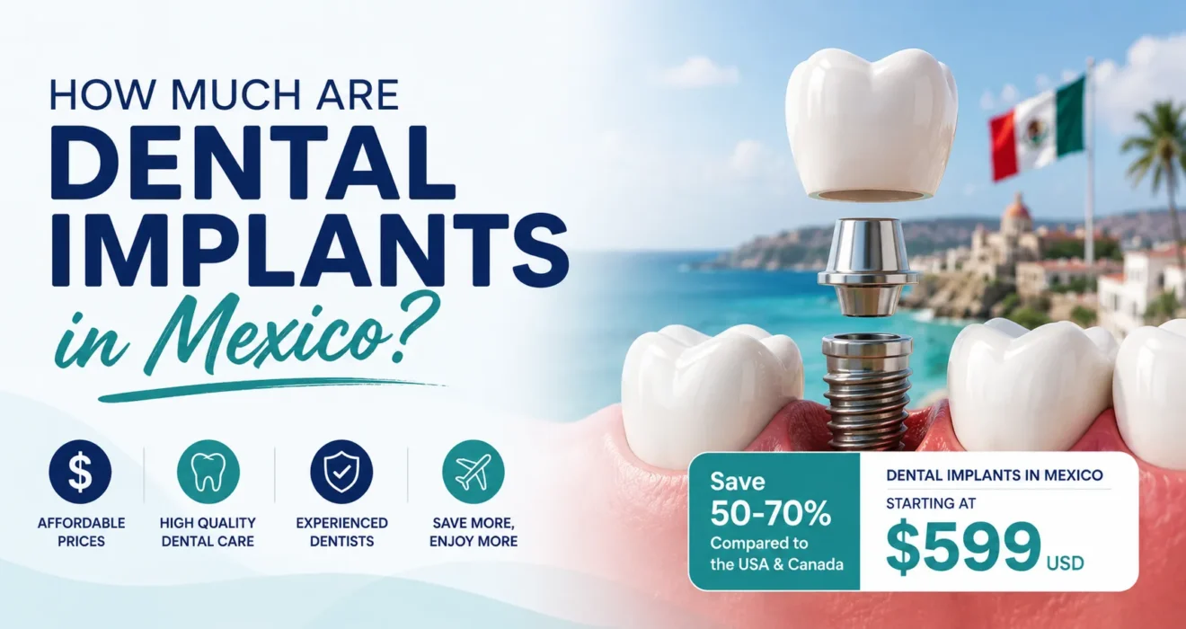 how much are dental implants in mexico