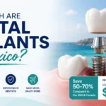 how much are dental implants in mexico