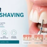 veneer teeth shaving